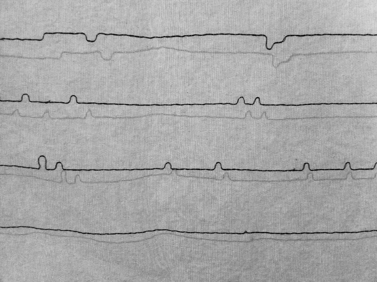 Fading In / Out - detail